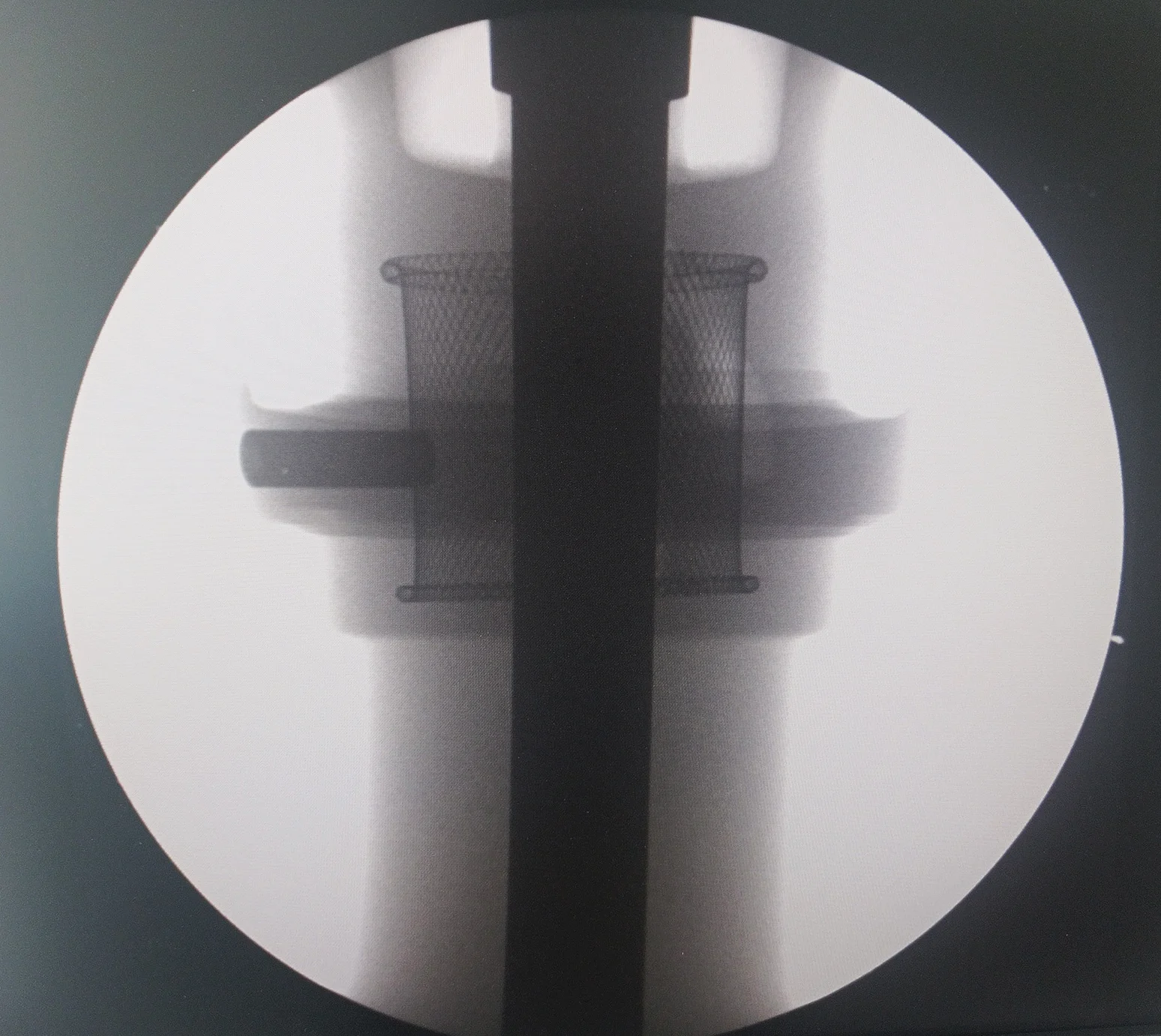 Turbine Blade X-Ray Inspection